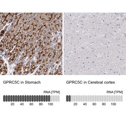 GPRC5C Antibody, Novus Biologicals 25 &mu;L; Unlabeled:Antibodies, Polyclonal